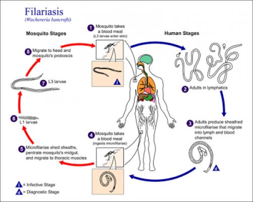 Atasi Filariasis, Ini Langkah yang Dilakukan Pemkab