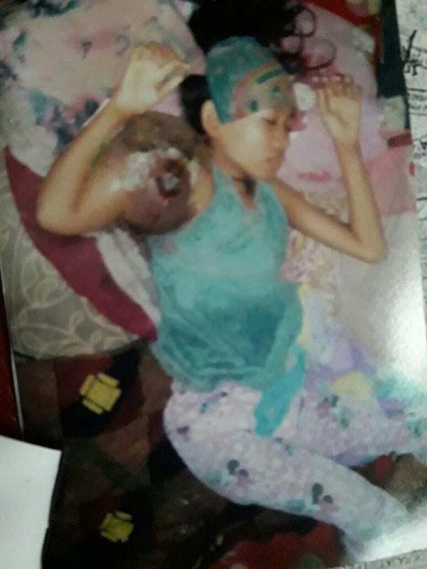 Derita Tumor Ganas  Murid SD Terbaring Tak Berdaya