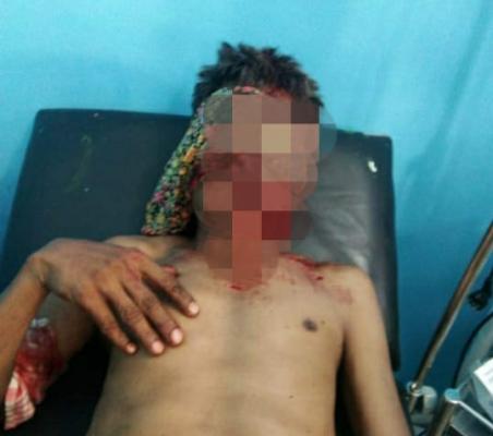 Pasangan Suami Istri bersimbah dara di duga di serang beruang