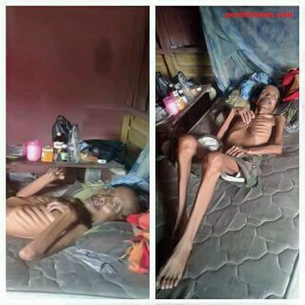 Ayo Bantu, Warga Miskin di Dumai Ini Derita Sakit Paru-paru