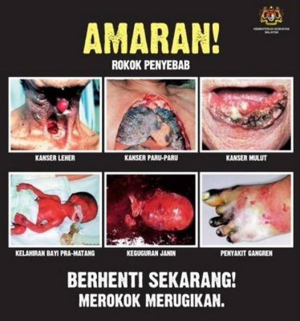 Usulan Partai Buruh Harga Rokok di Australia Rp 400 Ribu di Tahun 2020