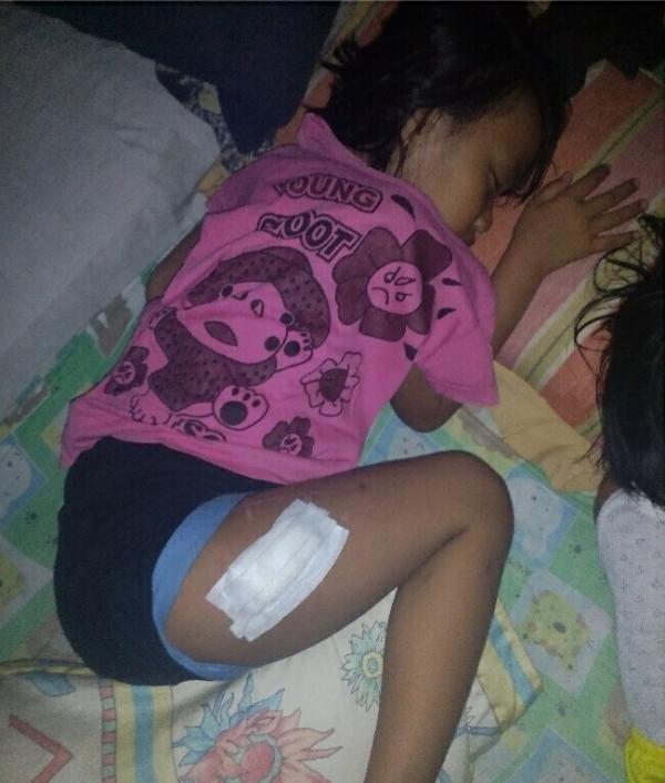 Ruli, Gadis Kecil Korban Tabrakan Yang Terancam Lumpuh