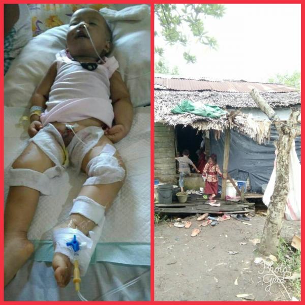 M Ridho bocah umur 1.4 tahun terbaring di rumah sakit butuh uluran tangan.