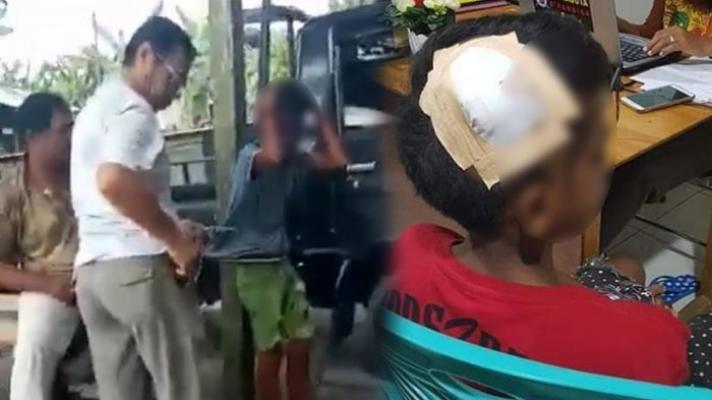 Bocah Ini Diperkusi hingga Kepala Terluka Karena Dituding Curi Ayam