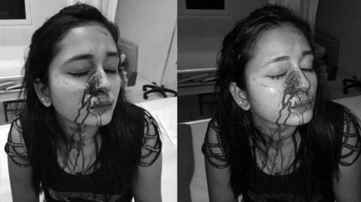 Gara-gara Lebih Cantik dan Galmor, Sosialita Ini Babak Belur Dipukuli Temannya 