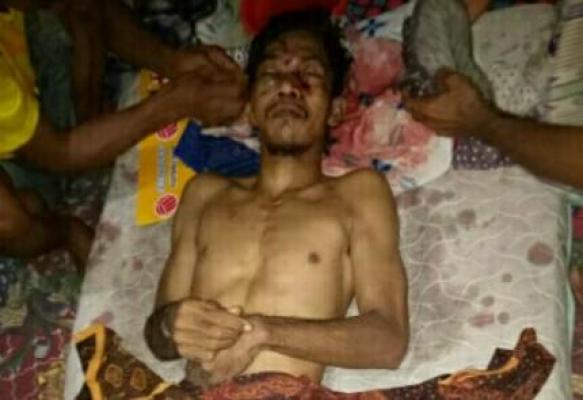 Nasip Malang Pencari Kayu,Di temui Teman Bersimbah Darah tak Bernyawa