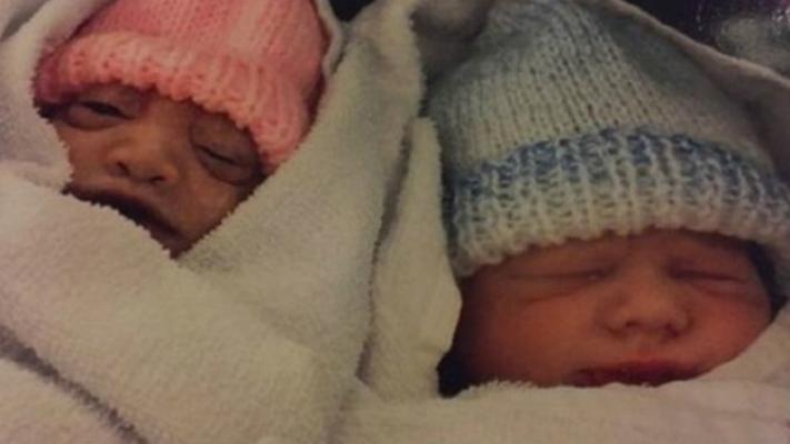 Bayi Usia 74 Menit Jadi Donor Organ Termuda