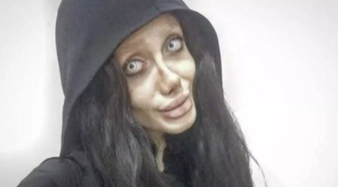 Remaja Ini Lakukan 50 Operasi Plastik demi Mirip Angelina Jolie