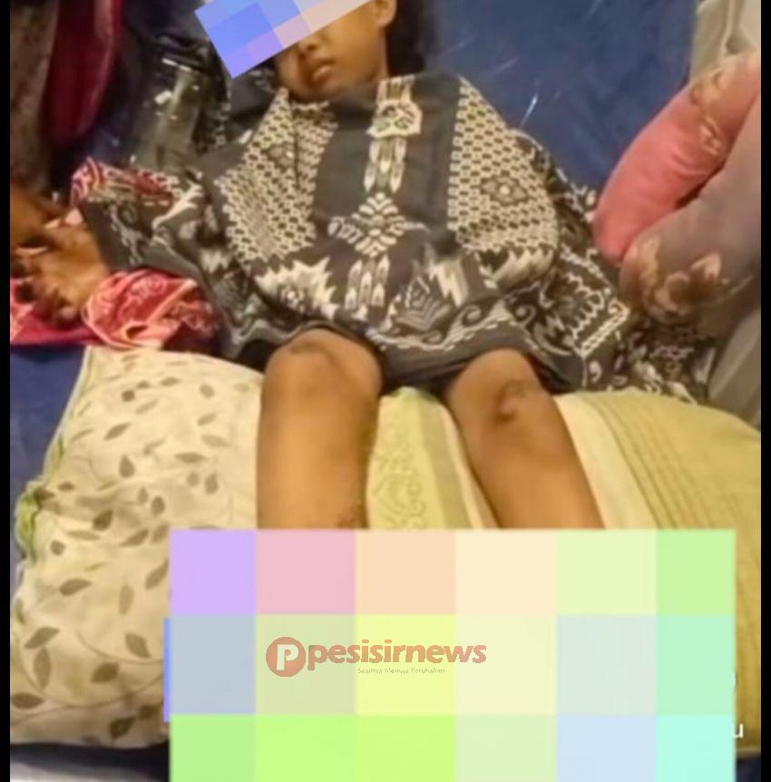 Polisi Lakukan Pulbaket Dugaan Bullying Siswi SD di Kemuning, Hasil Sementara Tidak Ditemukan Peristiwa Perundungan